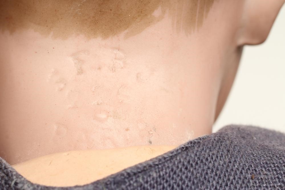 An S.F.B.J. bisque head character boy doll, with blue glass fixed eyes, moulded open mouth, painted Image