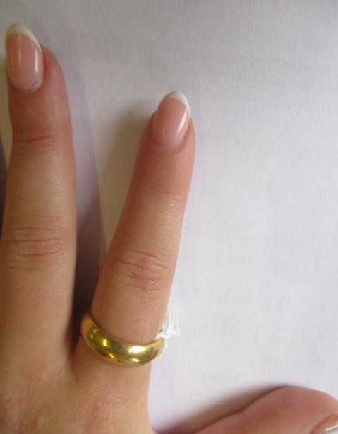 A 22CT GOLD WEDDING RING, Birmingham 1955, sponsor's mark SH, size Q, 11.9g (Est. plus 24% premium Image
