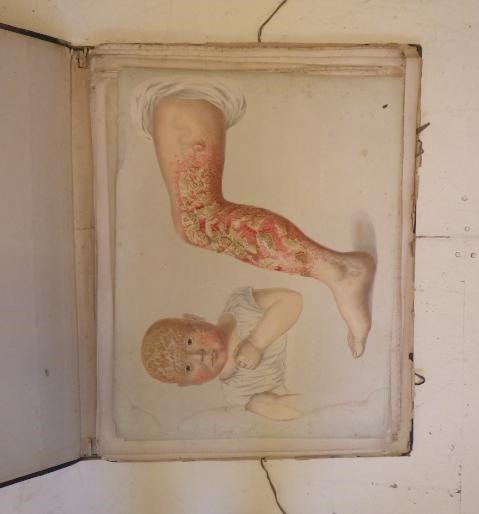 QUAIN'S ANATOMY OF THE ARTERIES Image