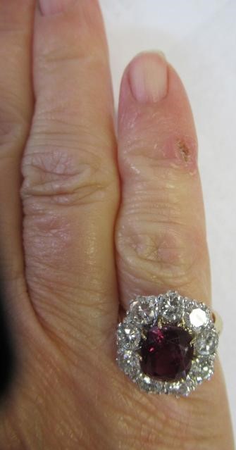 A RUBY AND DIAMOND CLUSTER RING Image