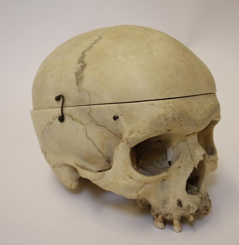 A HUMAN SKULL Image