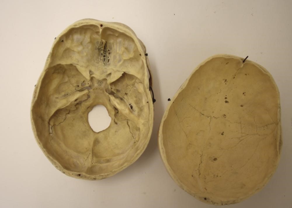 A HUMAN SKULL Image