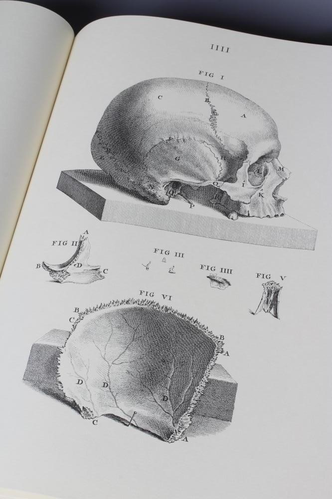 WILLIAM CHESELDEN, Osteographia, facsimile, no date, The Scholar Press, Ilkley, one of 500 copies, Image