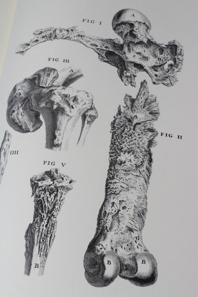 WILLIAM CHESELDEN, Osteographia, facsimile, no date, The Scholar Press, Ilkley, one of 500 copies, Image