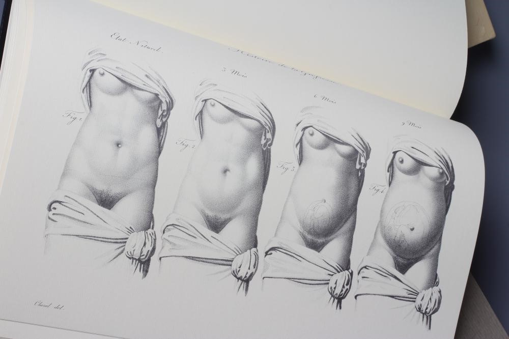 WILLIAM CHESELDEN Image