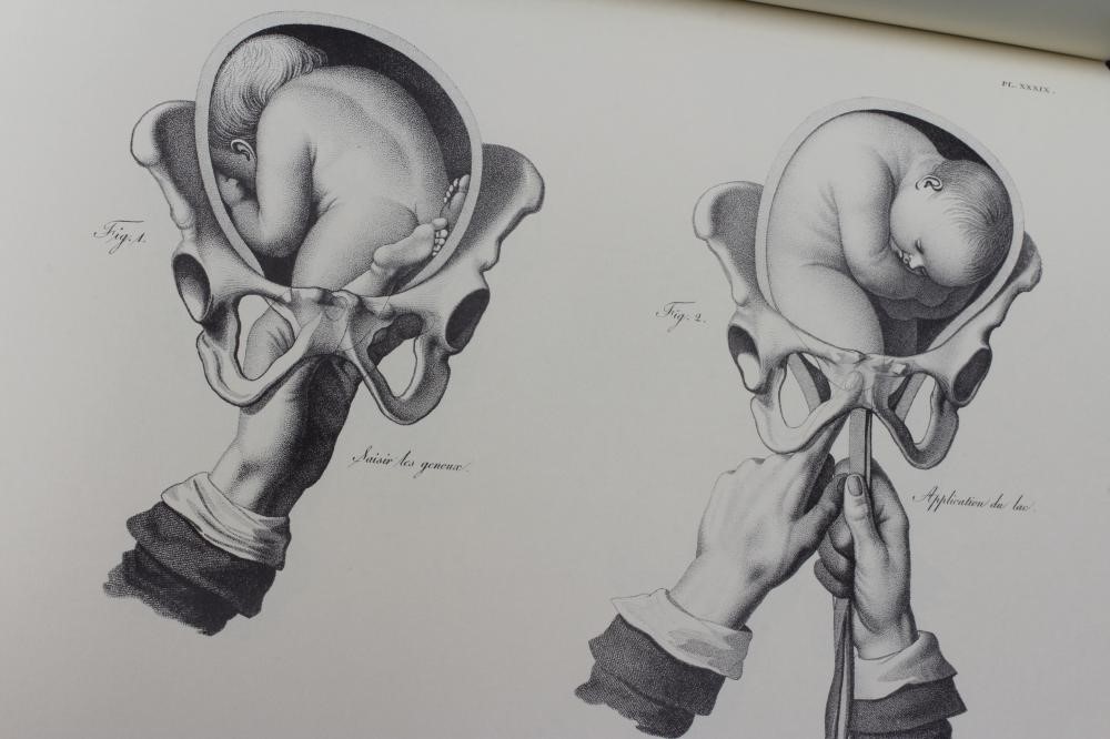 WILLIAM CHESELDEN Image
