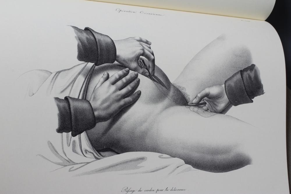 WILLIAM CHESELDEN Image